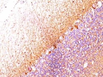 Neurofilament Antibody (clone SPM204)