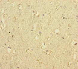 Polyclonal Rabbit anti-Human MTO1 Antibody (IHC, WB)