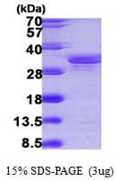 Human SUGT1 / SGT1 Protein (Recombinant His)