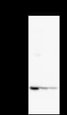 HARS Antibody (clone HARSA6)