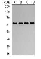 Polyclonal Rabbit anti-Human RBBP4 / RBAP48 Antibody (IHC, IF, WB)