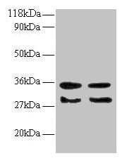 IHC-plus™ TGFA / TGF Alpha Antibody