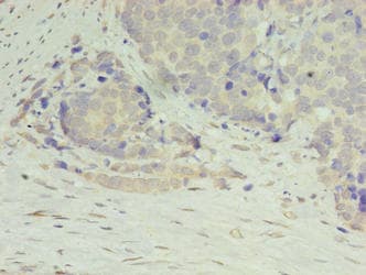 DIP2A Antibody