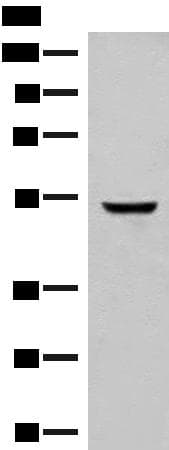 GLCCI1 Antibody