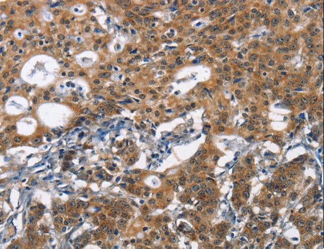 DCC Antibody