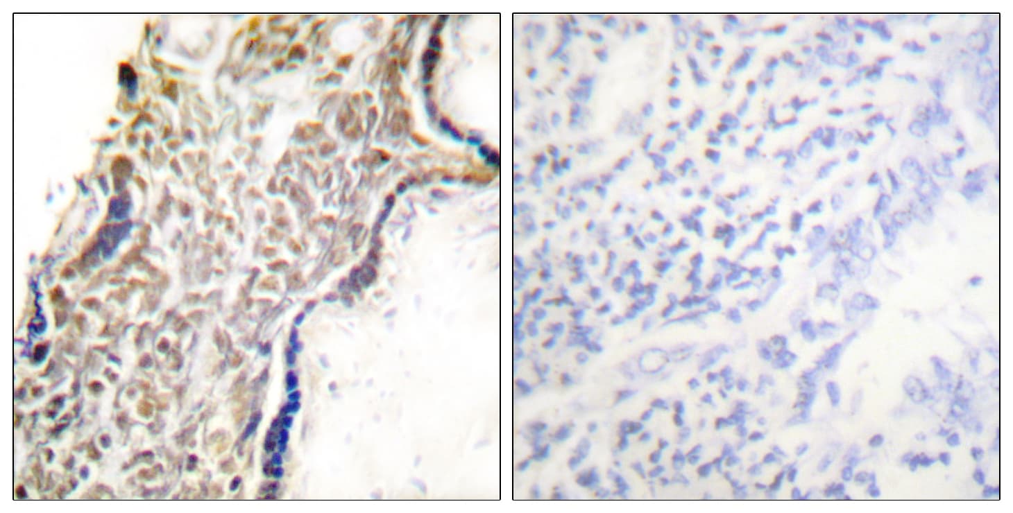 Polyclonal Rabbit anti-Human p14ARF / CDKN2A Antibody (aa71-120, IHC, IF, WB)