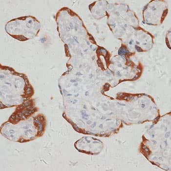 Polyclonal Rabbit anti-Human SARS2 / SYS Antibody (IHC, WB)