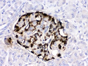 Polyclonal Rabbit anti-Human Gastric Inhibitory Peptide Antibody (IHC, WB)