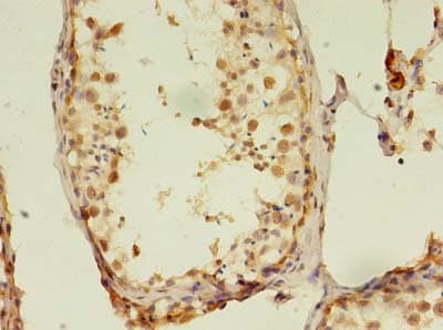 Polyclonal Rabbit anti-Human RTKN2 Antibody (IHC)