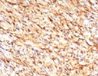 S100B / S100 Beta Antibody (clone S100B/1012, Azide-free, BSA-free)