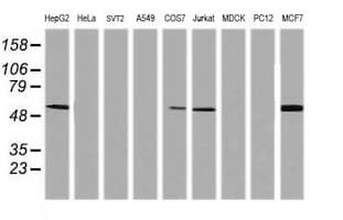 TAPBPL / TAPBPR Antibody (clone OTI4H5)