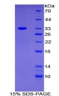 Human SLC4A1 / Band 3 / AE1 Protein (Recombinant His-T7)