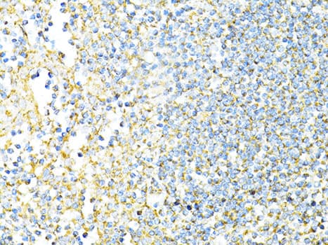 Polyclonal Rabbit anti-Human CD8A / CD8 Alpha Antibody (IHC, WB)