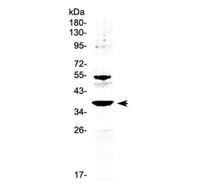 AMD / AMD1 Antibody