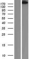 SMMHC / MYH11 Protein (Over-Expression Lysate Myc-DDK (Flag))