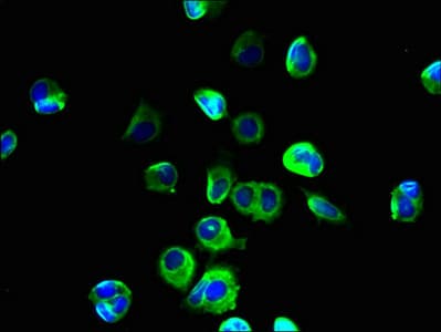SLC39A11 / ZIP11 Antibody