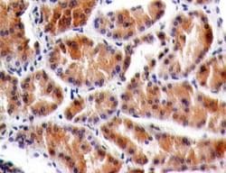 Monoclonal Mouse anti-Human CRLF2 / TSLPR Antibody (clone 59N5G4, aa119-231, IHC, WB)