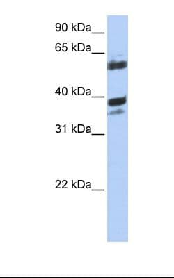 DNAJB1 / Hsp40 Antibody (aa74-123)