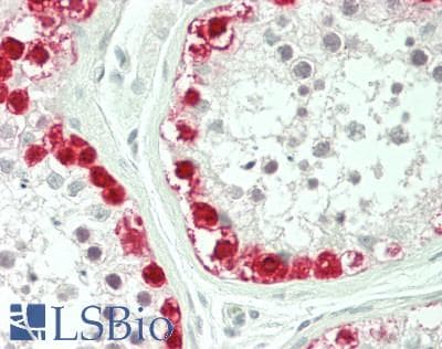 IHC-plus™ MAGEA3 Antibody (clone 2F10)