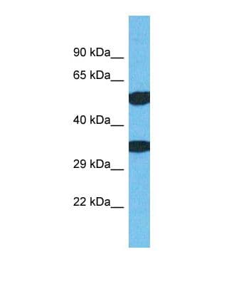 TMEM68 Antibody (N-Terminus)
