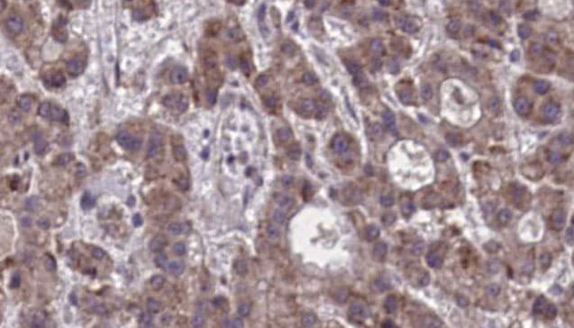 Polyclonal Rabbit anti-Human GPR44 / CRTH2 Antibody (IHC, WB)
