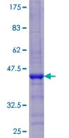 Human CDKAL1 Protein (Recombinant GST)