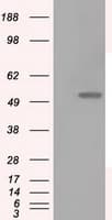 LOX / Lysyl Oxidase Antibody (aa22-168, clone OTI4E3, Carrier-free)