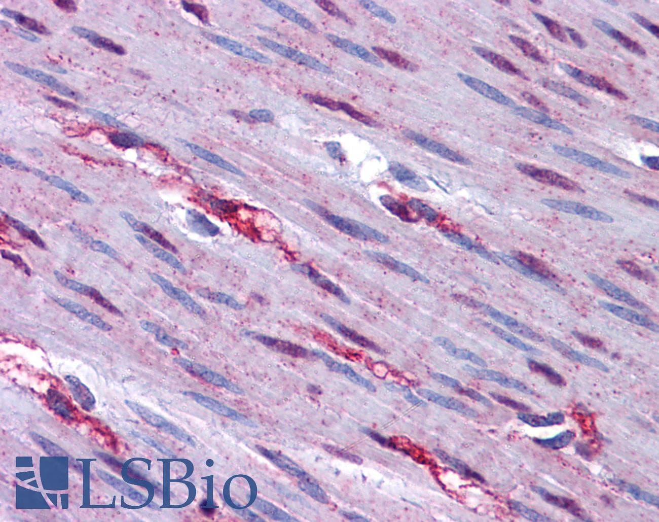 IHC-plus™ Polyclonal Rabbit anti-Human FOXO3 / FOXO3A Antibody (IHC, IF, WB)