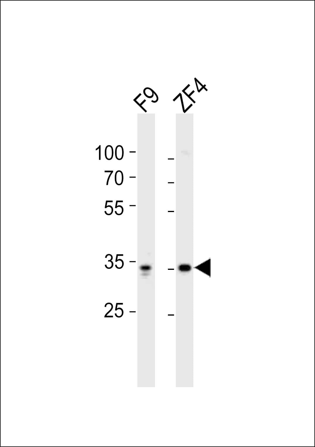 Polyclonal Rabbit anti-Human WDR82 / TMEM113 Antibody (aa50-85, WB)