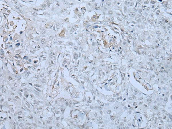 HUWE1 / ARFBP1 Antibody
