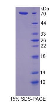 Rat TJP1 / ZO-1 Protein (Recombinant His-S)