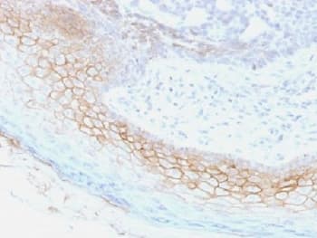 Desmocollin 2+3 Antibody (clone 7G6, Azide-free, BSA-free)