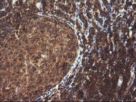 Monoclonal Mouse anti-Human TRIM44 Antibody (clone OTI1E10, IHC, IF, WB)