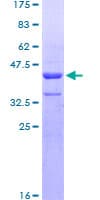 Human ZNHIT3 Protein (Recombinant GST)