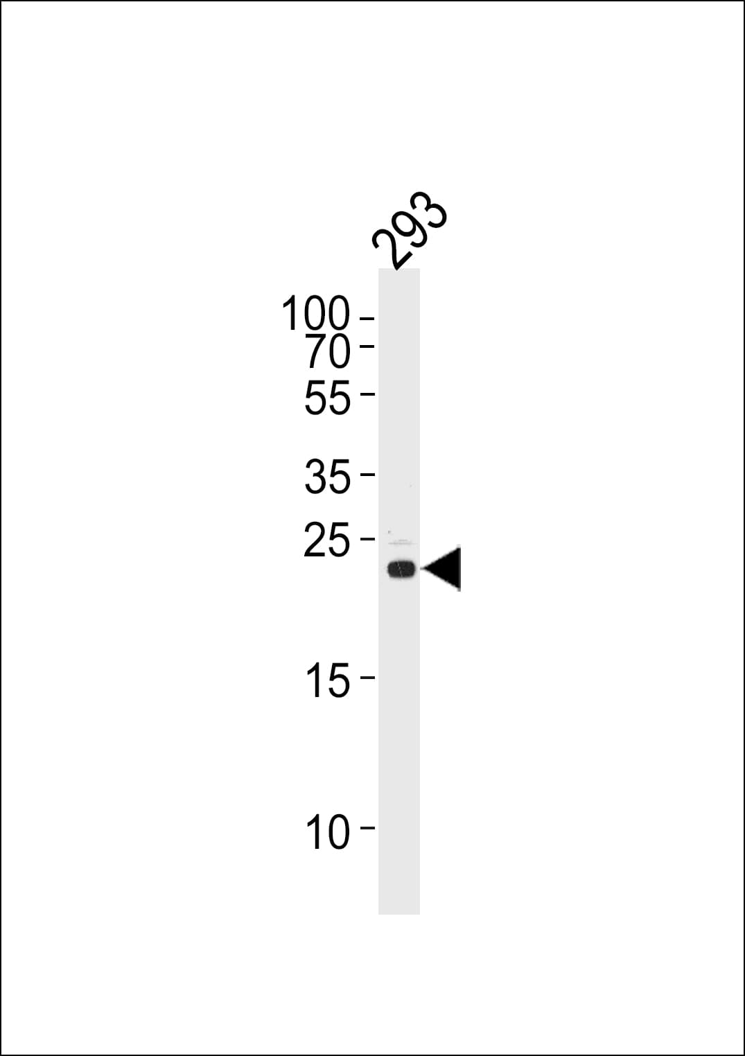 Polyclonal Rabbit anti-Human RSPO2 Antibody (aa190-218, IHC, WB)