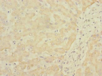 SOAT2 Antibody