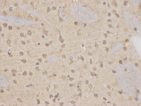 Polyclonal Rabbit anti-Human MAP2K7 / MEK7 Antibody (IHC, IF, WB)