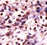 UCK2 Antibody (aa1-30)