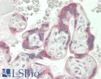 IHC-plus™ Polyclonal Rabbit anti-Human ADCY4 / Adenylate Cyclase 4 Antibody (Internal, IHC, WB)