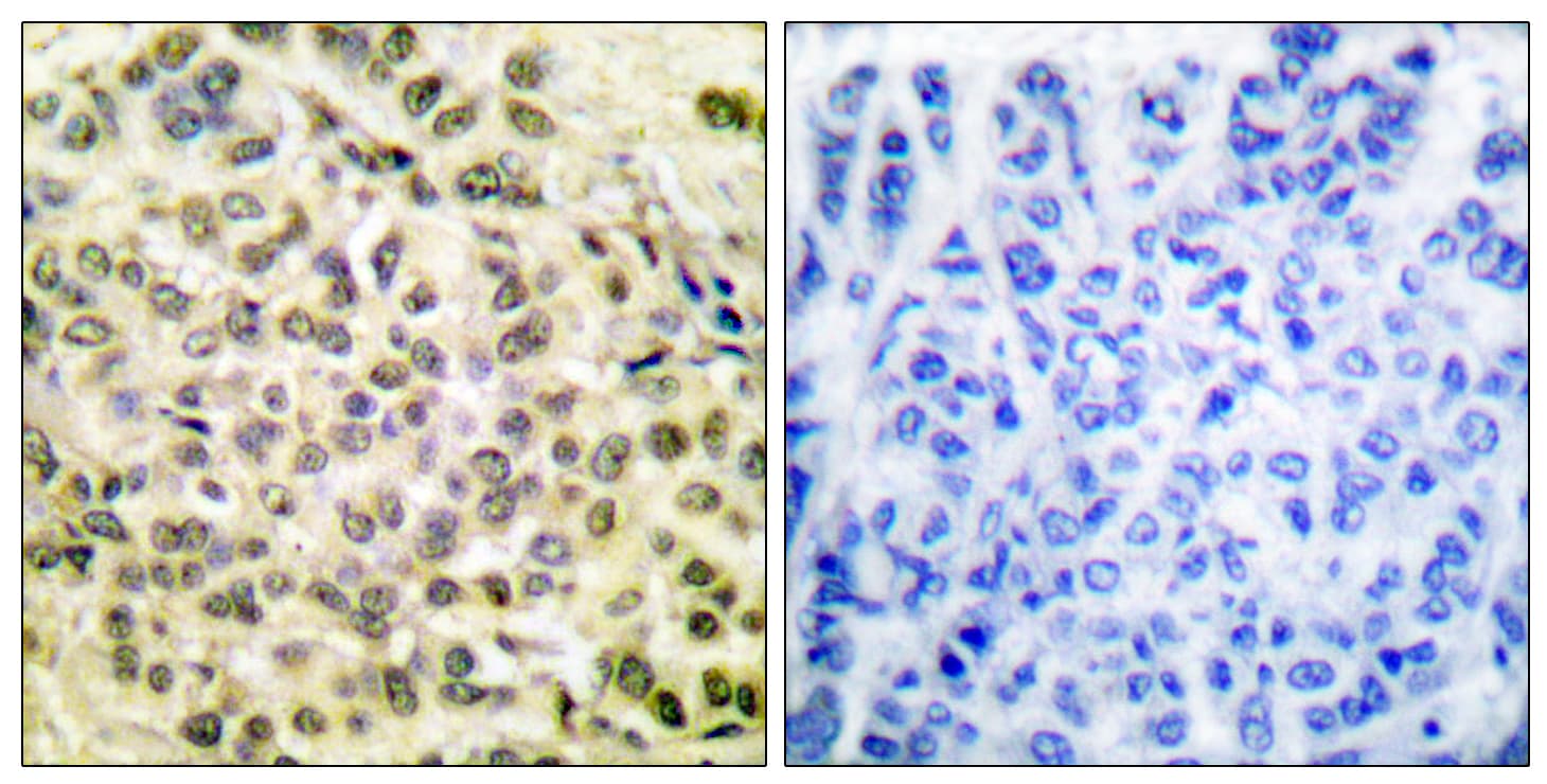 C/EBP Beta / CEBPB Antibody (phospho-Thr235/Thr188)
