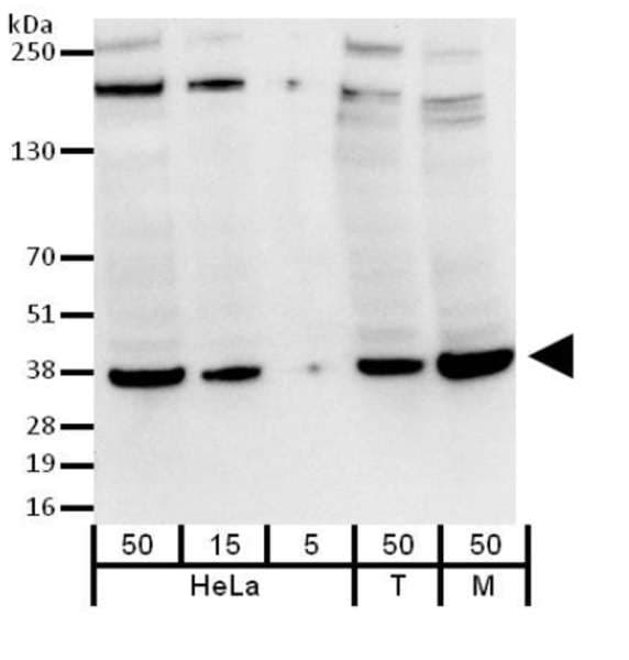 Monoclonal Mouse anti-Human GAPDH Antibody (aa150-200, IHC, WB)