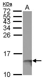 IHC-plus™ B2M / Beta 2 Microglobulin Antibody