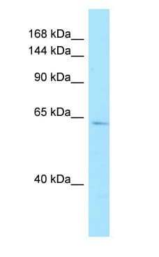 AMPD3 Antibody (C-Terminus)