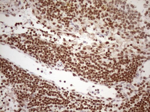 EXOSC1 / CSL4 Antibody (clone OTI4B7)