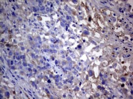 Monoclonal Mouse anti-Human PIK3C2A Antibody (clone OTI3D9, aa230-560, IHC, WB)