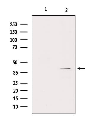 Polyclonal Rabbit anti-Human GNA11 Antibody (IHC, WB)