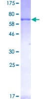Human RET Protein (Recombinant GST)