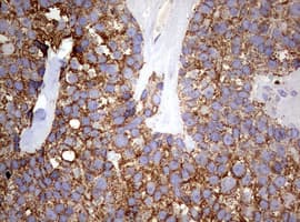 PIK3CD / PI3K Delta Antibody (aa286-610, clone OTI1D11)