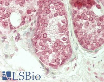 IHC-plus™ RANBP2 / TRP1 Antibody (aa2600-2650)