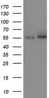 CAT / Catalase Antibody (clone 1B6, Carrier-free)